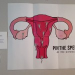 Pin the Sperm